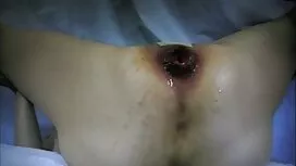 عرض شانه, گپ تلگرام  ...