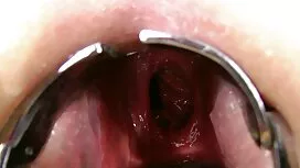 لاغر, خوردن چرک, مهب ...
